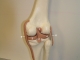 post_knee_hr.jpg