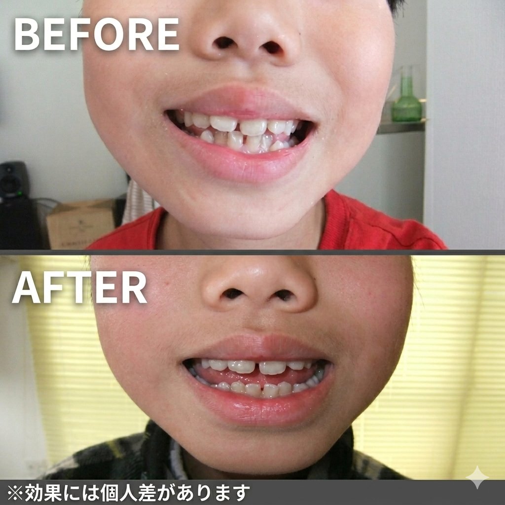 整体による改善例2 BEFORE AFTER