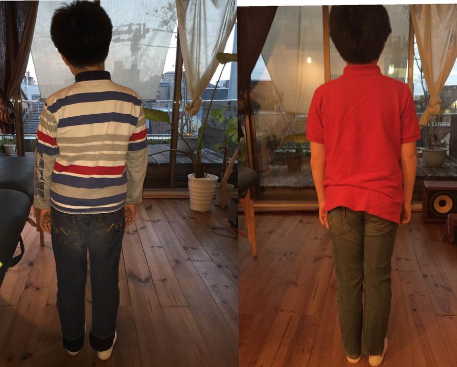 芦屋の子ども整体 姿勢改善ビフォーアフター 症例1 - Ease Garden