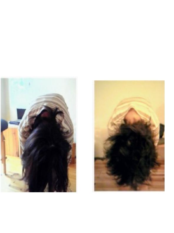 学童期の側弯症・猫背ケア 姿勢改善 症例1 - 芦屋市 Ease Garden
