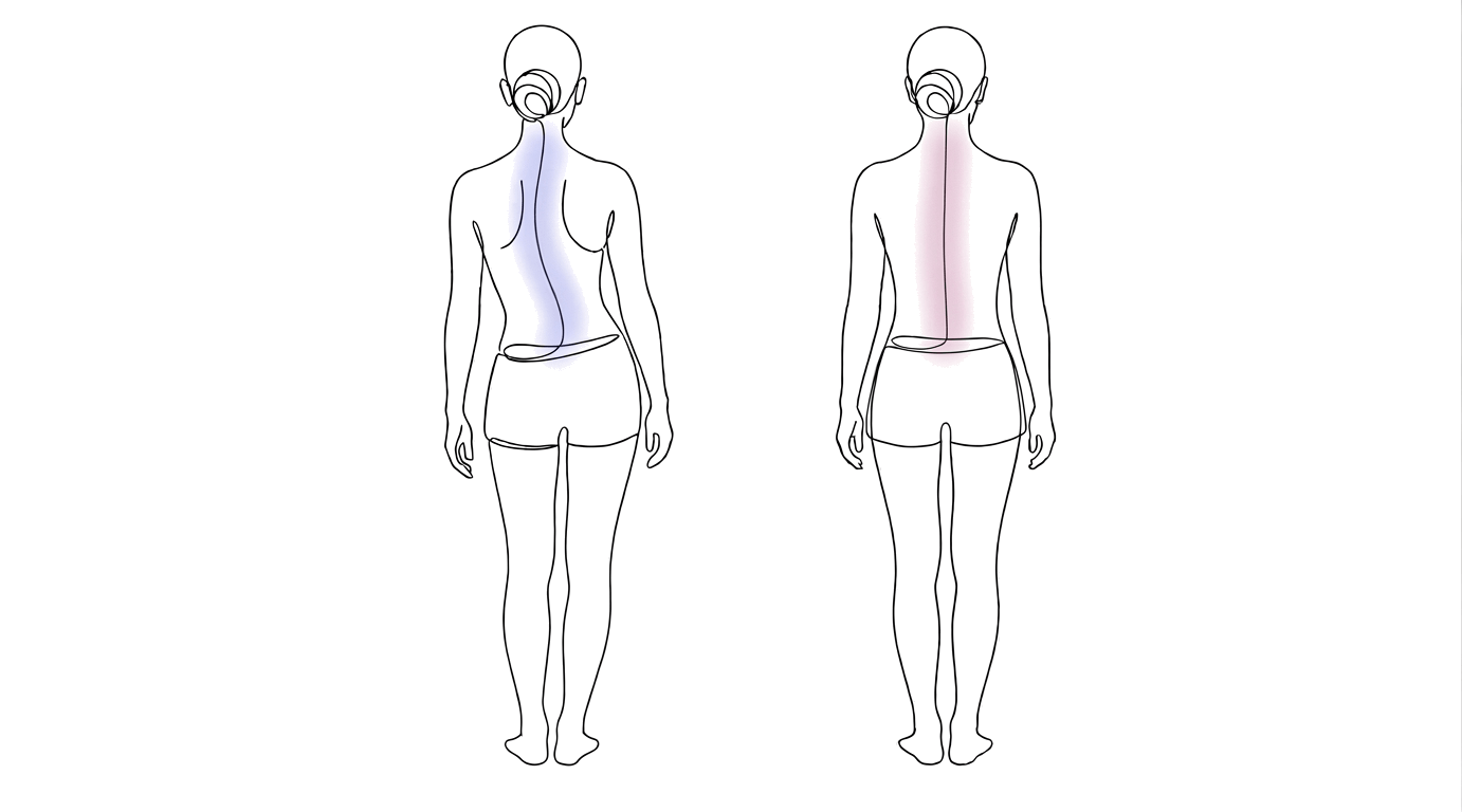 芦屋市の側弯症整体｜全身の回旋バランスのイメージイラスト